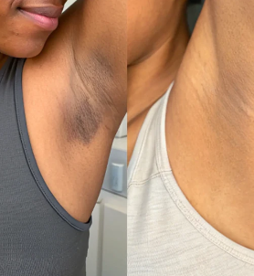 Savon à l’Acide Kojic – Floralys