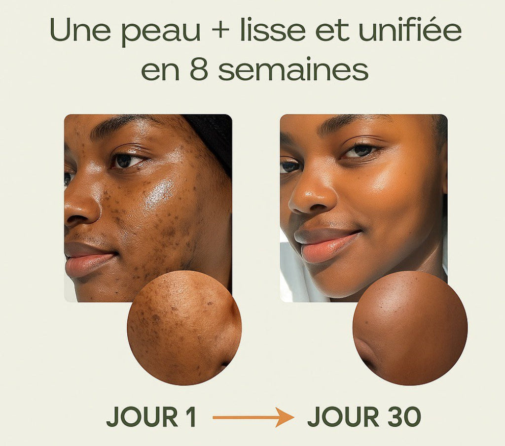 Savon à l’Acide Kojic – Floralys
