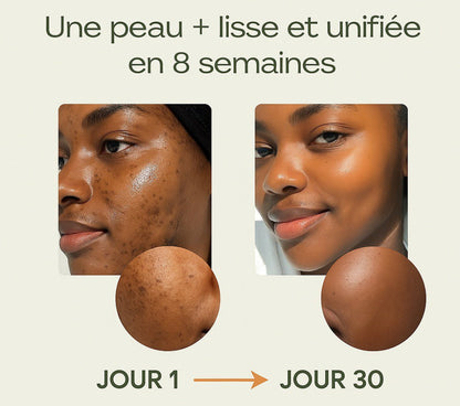 Savon à l’Acide Kojic – Floralys