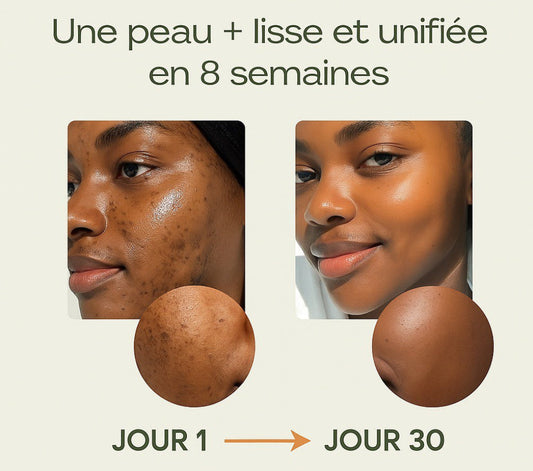 Routine Anti Imperfections Floralys